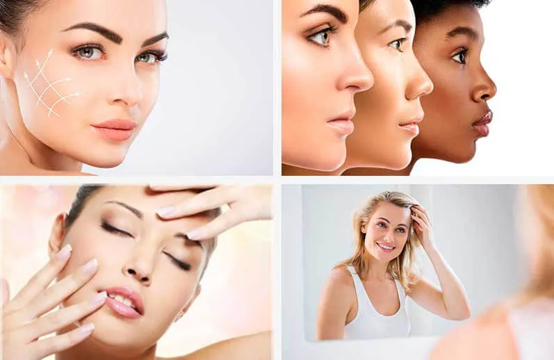 Imagem 1 - O que é Lift Gold